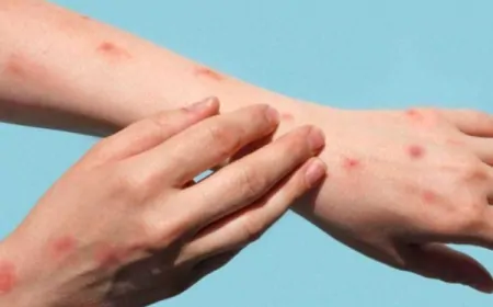 अगर भारत में फैला मंकीपॉक्स तो कितना होगा असर, जानें कैसे करें बचाव