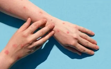 भारत में मंकीपॉक्स का पहला मामला आया सामने, केंद्र सरकार ने किया आधिकारिक ऐलान