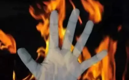 जिंदगी की जंग हार गई पुरी की बेटी, दिल्ली AIIMS में तोड़ा दम