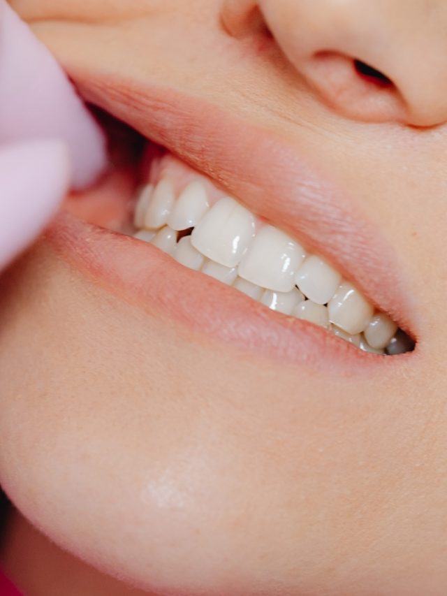 पीले दांतो को चमकाने के लिए अपनाएं ये 5 आसान घरेलू उपाय