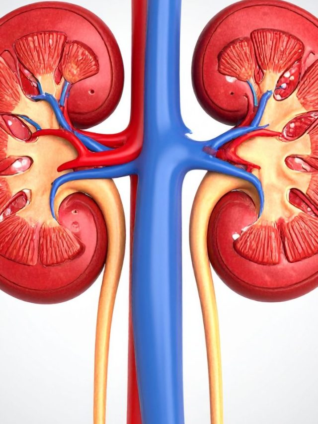 Kidney Stones के मरीज भूलकर न खाएं ये 3 फूड्स