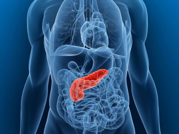 पैंक्रियाटिक कैंसर